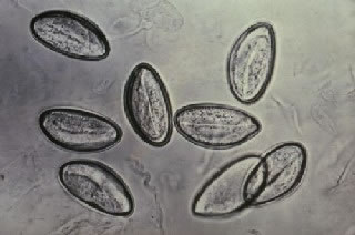 Huevos de E. Vermicularis bajo el microscopio