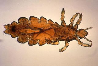 <strong>Head Louse</strong> 