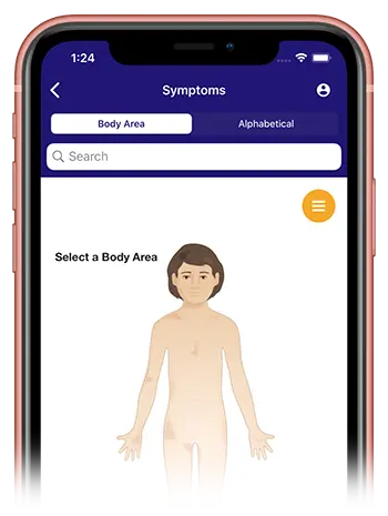 A cell phone screen displaying a body area diagram.